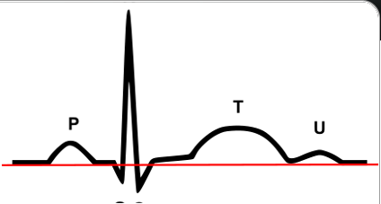 Athlete Performance Test Chart